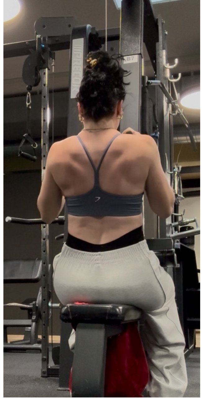 Dieselbe Klientin im Gym, Rückansicht, nachher